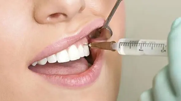 چرا برخی از دندان ها بی حس نمی شود؟ / چاره بی حس نشدن دندان چیست؟