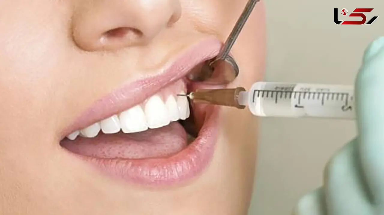 چرا برخی از دندان ها بی حس نمی شود؟ / چاره بی حس نشدن دندان چیست؟