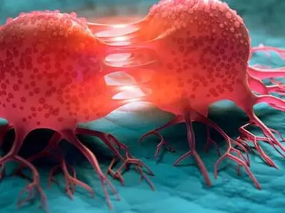 40 درصد سرطان‌ ها قابل پیشگیری‌ اند؛ واکسن HPV در دست بررسی / سرطان های شایع در زنان و مردان