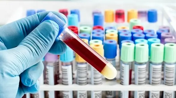 فقر آهن را با این 7 نشانه تشخیص دهید