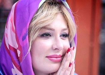 رونمایی نیوشا ضیغمی از بینی اش بعد از عمل زیبایی مجدد / خانم بازیگر مدام در کلینیک های زیبایی !