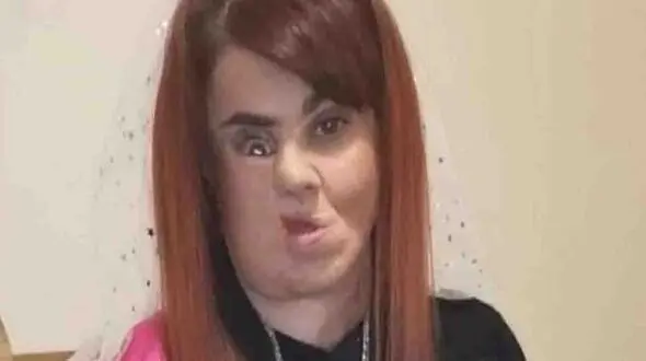 حشره گوشتخوار صورت دختری را خورد ! + عکس های تلخ