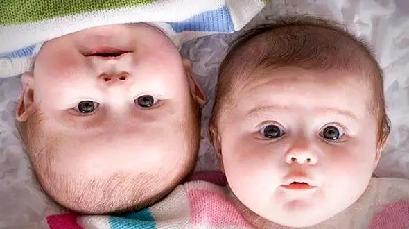 پادرازترین زن جهان کیست ؟! + عکس های حیرت آور