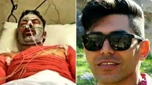 ناگفته هایی از روزهای سخت آتش نشان شهید "البرز زارع" / بیمارستان متهم به کم کاری ! + عکس