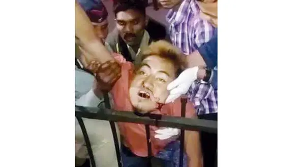  عکسی عجیب از یک حادثه/باور می کنید این مرد هنوز زنده باشد؟!+عکس