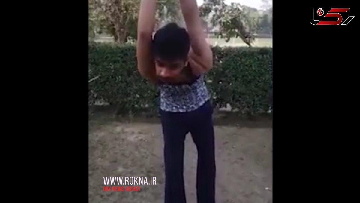 جوانی که می تواند شانه اش را 360 درجه بچرخاند+فیلم