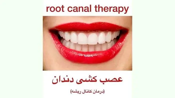 عصب کشی دندان چگونه است؟ + فیلم