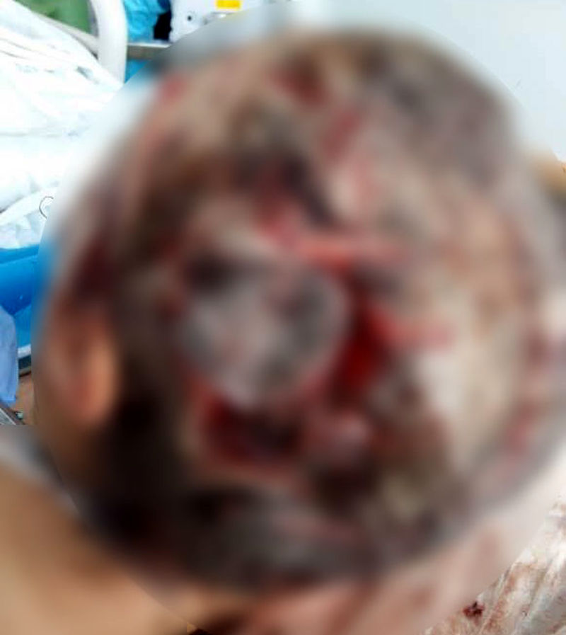 ضرب و شتم اشرف سادات توسط شوهر