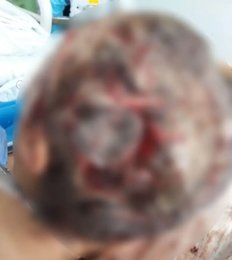 ضرب و شتم اشرف سادات توسط شوهر