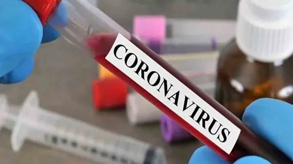 کرونا به جان کارمندان شهرداری تهران افتاد / اعلام نتیجه تست کرونای حناچی