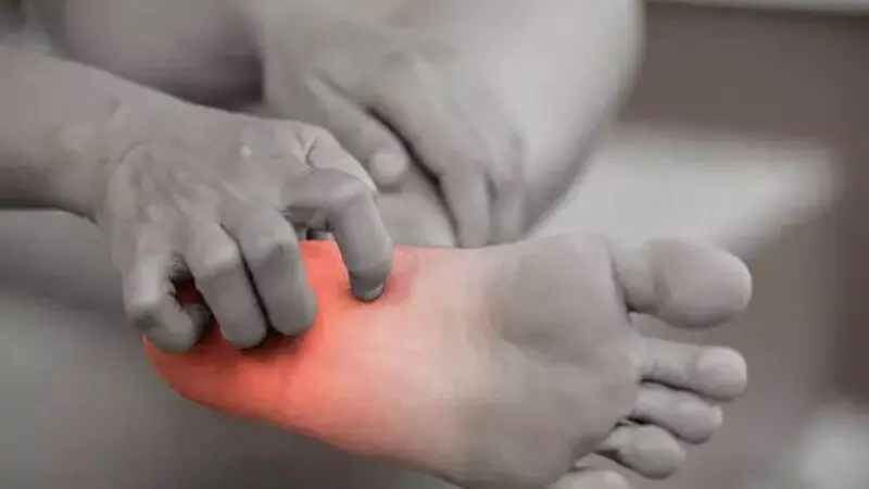داغ شدن کف پا