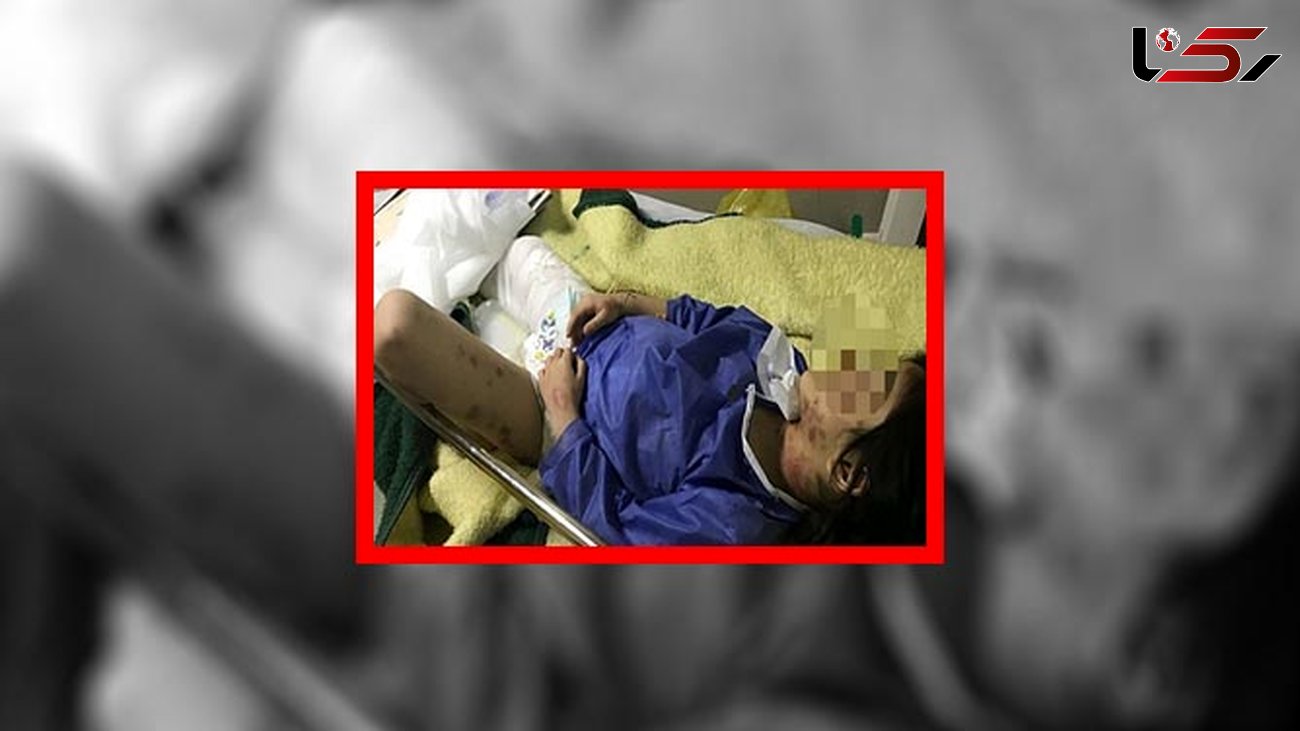 جزییات سرنوشت کودک شکنجه شده در مهاباد + عکس