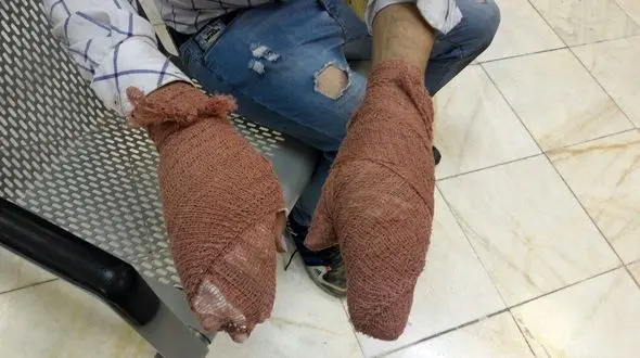  ٤نفر کشته و ٣‌هزار و ٤٤٦ نفر مصدوم در آتش بازی های بی حساب