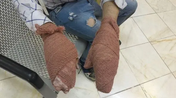  ٤نفر کشته و ٣‌هزار و ٤٤٦ نفر مصدوم در آتش بازی های بی حساب