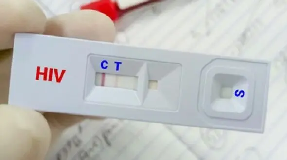 تغییر الگوی شیوع HIV در ایران؛ انتقال جنسی جایگزین اعتیاد تزریقی شد