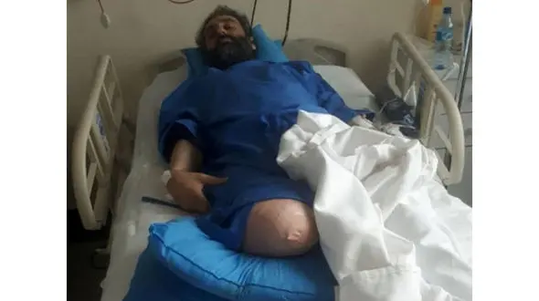 قطع شدن پای محیط بان خوزستانی / 4 نقابدار خشن از سید چه می خواستند؟ + عکس