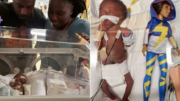 عجیب اما واقعی/ دختری که از عروسک باربی هم کوچکتر است + فیلم 