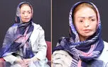 چهره دختر تبریزی را به او برگردانید ! / رویای زیبایی معصومه عزتی! + فیلم