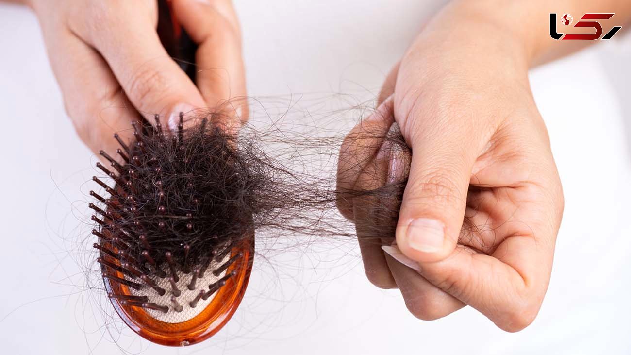 توقف ریزش مو با کدام ویتامین ممکن است؟