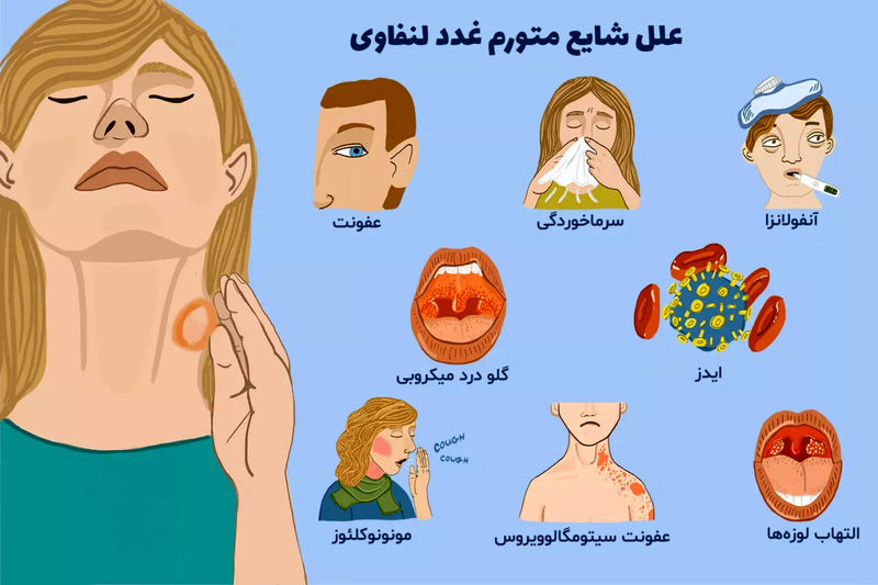 علل تورم غدد لنفاوی