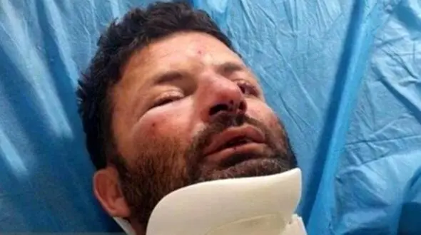 حمله وحشیانه 3 متخلف به محیط‌بان در شمال تهران