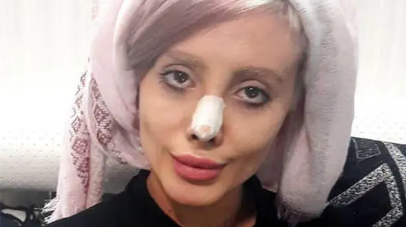 سحر تبر چگونه در اینستاگرام متولد شد؟! / جزئیات دستگیری عروس مرده و تصاویر قبل و بعد جراحی هایش