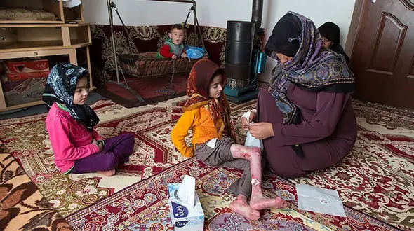 مرگ خاموش بیماران پروانه ای در سایه تحریم های دارویی / تامین دارو در شرایط جنگ سخت تر بود 