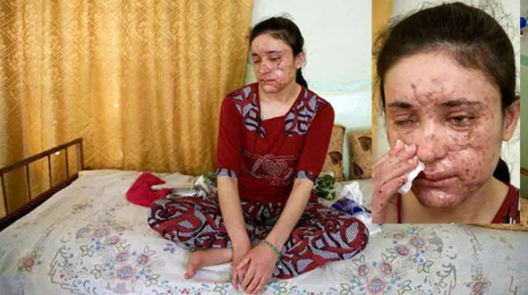 ناگفته دختر فراری از همخوابی های وحشیانه با داعش ++عکس