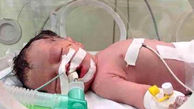 رهایی اجساد 2 نوزاد در 2 بیمارستان پایتخت