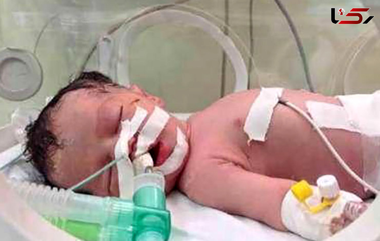 رهایی اجساد 2 نوزاد در 2 بیمارستان پایتخت