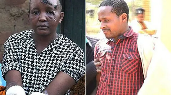 دست های زن نابارور توسط همسرش قطع شد+جزئیات و عکس شوهر و زن پس از حادثه