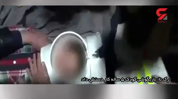 بلای عجیب که به خاطر بازیگوشی یک بچه 5 ساله رخ داد+فیلم و عکس