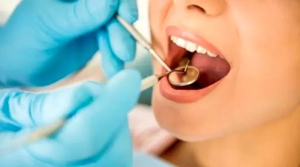 ارتباط نازایی با دندان های پوسیده