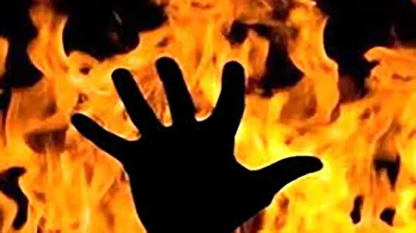 زنده زنده سوختن مرد 21 ساله در آجودانیه تهران 