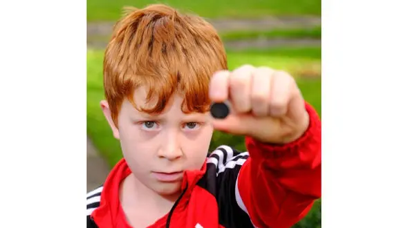 سرنوشت عجیب کودکی که باتری قورت داد! + عکس 