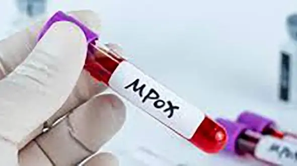 شیوع آبله میمون/ آیا خطر ورود این بیماری به ایران جدی است؟