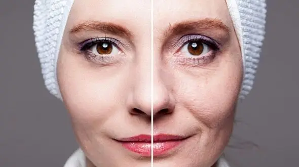 10 راهکار موثر برای جلوگیری از چین و چروک صورت