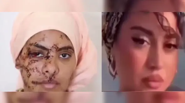 فیلم 130 بخیه بر صورت و دستان زن جوان /  شوهر سابقش صورت زیبای او را با چاقو خط خطی کرد