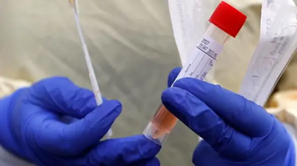 پشت پرده تست های کرونایی 3 پزشک در کرج