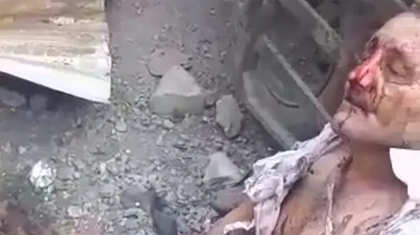 فیلم وحشتناک قطع شدن پاهای مرد جوان در انفجار کپسول اکسیژن