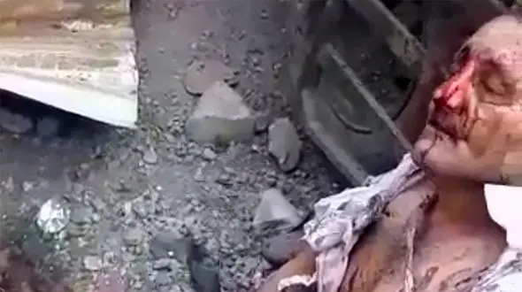 فیلم وحشتناک قطع شدن پاهای مرد جوان در انفجار کپسول اکسیژن