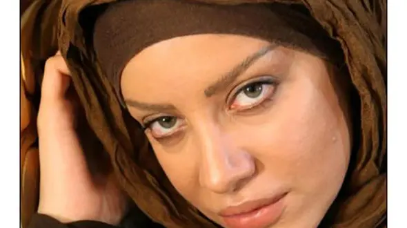 شراره رخام : ژل لب باعث بیکاریم شد/ برخی فقط دنبال کسب شهرت و خوش گذرانی هستند