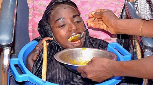 دختری که در یک تشت زندگی می‌کند +عکس