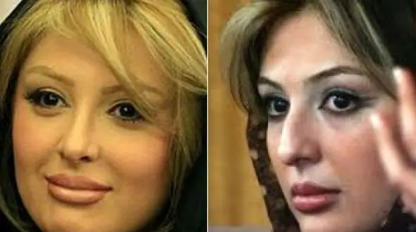 چهره بازیگران زن ایرانی قبل و بعد از جراحی بینی +تصاویر