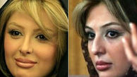 چهره بازیگران زن ایرانی قبل و بعد از جراحی بینی +تصاویر