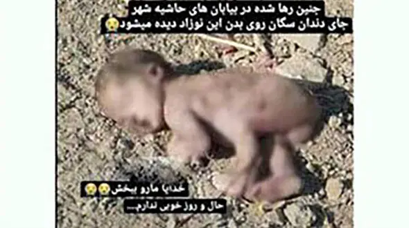 فاجعه / بچه زن کارتن خواب اصفهان دریده شد + عکس