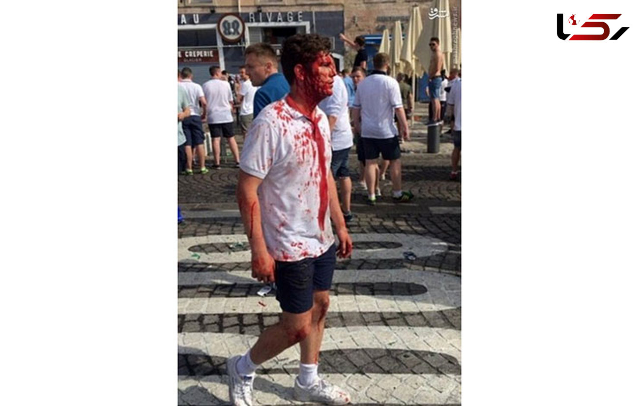 تصاویر جالب از درگیری خونین هواداران جام یورو + عکس