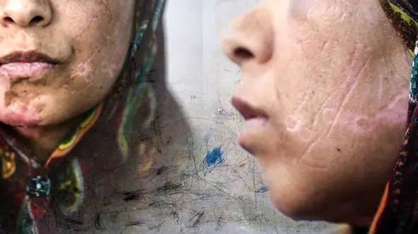 گفتگو با شوهر اعظم + عکس