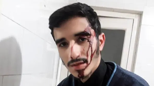 کتک خوردن خونین طلبه جوان / در مسعودیه رخ داد + عکس