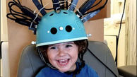  تولید کلاه اسکنر مغزی مخصوص رصد مغز کودکان